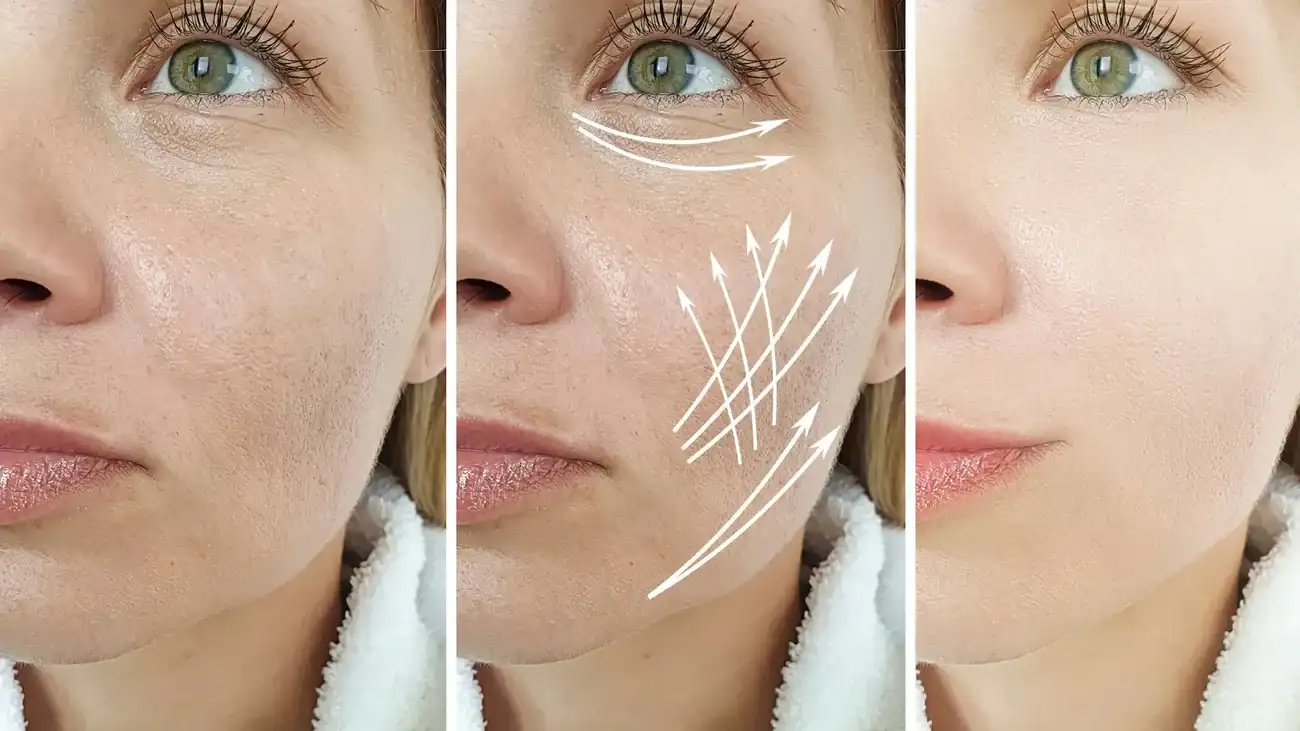 Can One Treatment Really Tackle More Than One Skin Concern Hamilton?