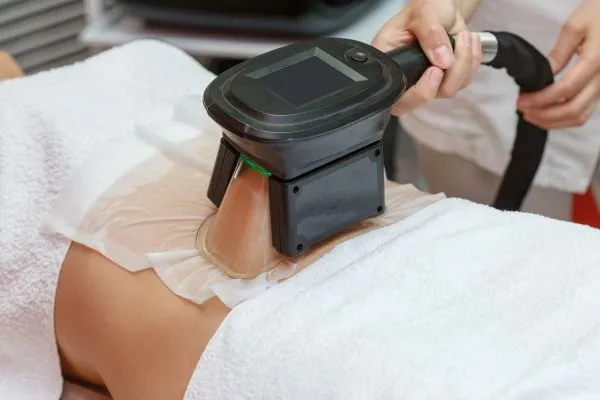 Image of person having fat freezing treatment to help weight gain Hamilton
