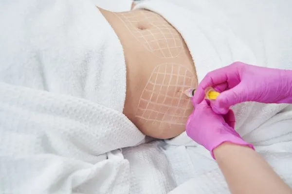 image of fat dissolving injections on love handles to help combat weight gain Hamilton