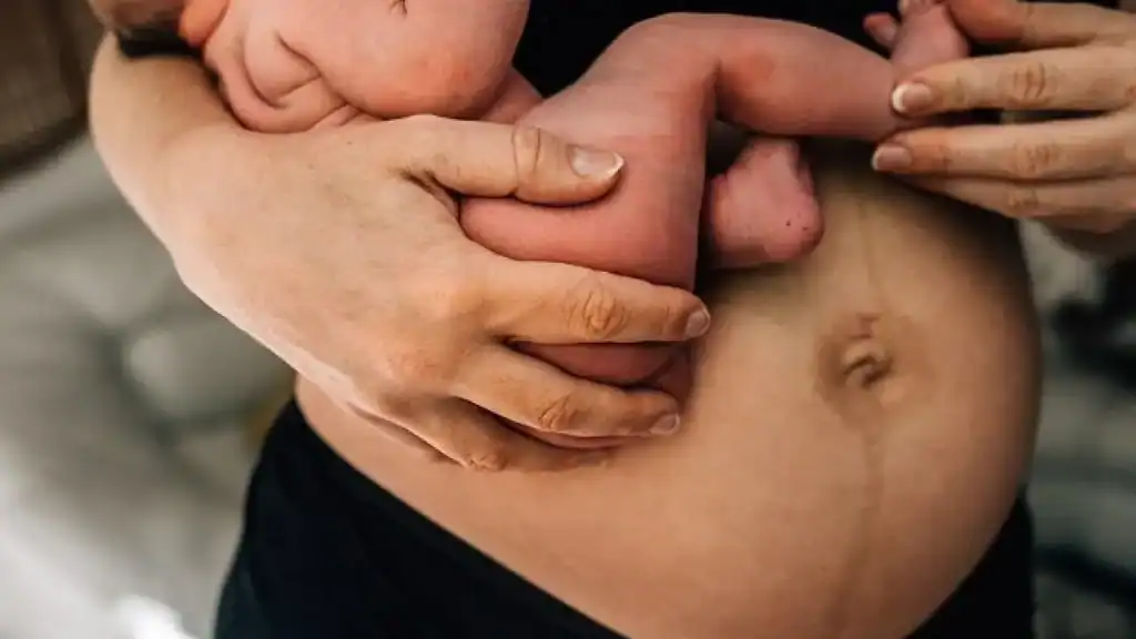 Why Is My Stomach Still Big After Pregnancy Hamilton?